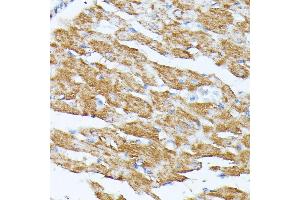 Immunohistochemistry (IHC) image for anti-Potassium Inwardly-Rectifying Channel, Subfamily J, Member 15 (KCNJ15) (AA 221-375) antibody (ABIN7269475)