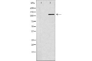 Western blot analysis of Hela whole cell lysates, using SMARCA5 Antibody. (SMARCA5 抗体  (C-Term))