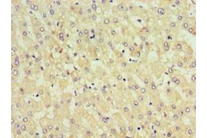 Immunohistochemistry of paraffin-embedded human liver tissue using ABIN7157655 at dilution of 1:100 (KIF6 抗体  (AA 565-814))