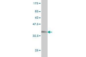 Western Blot detection against Immunogen (36. (ARAF 抗体  (AA 151-250))