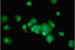 Immunofluorescent analysis of MCF-7 cells using ABIN7168469 at dilution of 1:100 and Alexa Fluor 488-congugated AffiniPure Goat Anti-Rabbit IgG(H+L) (RUSC1 抗体  (AA 231-433))
