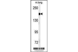 Image no. 1 for anti-Insulin Receptor (INSR) (Tyr1185) antibody (ABIN381200) (Insulin Receptor 抗体  (Tyr1185))
