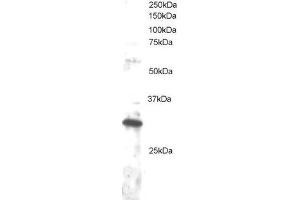 ABIN2562232 staining (1µg/ml) of Jurkat lysate (RIPA buffer, 30µg total protein per lane). (DKK4 抗体  (C-Term))