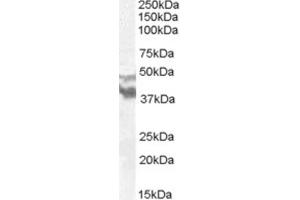 Western Blotting (WB) image for anti-Dyslexia Susceptibility 1 Candidate 1 (DYX1C1) (N-Term) antibody (ABIN2466680) (DYX1C1 抗体  (N-Term))