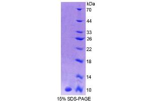 SDS-PAGE analysis of Human CALY Protein. (CALY 蛋白)