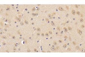 Detection of CAMLG in Mouse Cerebrum Tissue using Polyclonal Antibody to Calcium Modulating Ligand (CAMLG) (CAMLG 抗体  (AA 1-187))