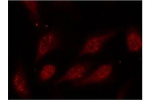 Image no. 2 for anti-Tumor Protein P53 (TP53) (pSer315) antibody (ABIN196788) (p53 抗体  (pSer315))
