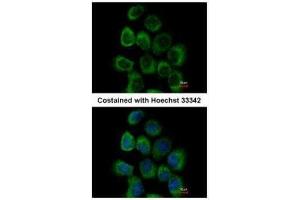 ICC/IF Image Immunofluorescence analysis of paraformaldehyde-fixed A431, using alpha Dystroglycan, antibody at 1:500 dilution. (Dystroglycan 抗体)
