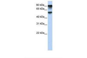 Image no. 1 for anti-TBC1 Domain Family, Member 10B (TBC1D10B) (AA 720-769) antibody (ABIN6739066) (TBC1D10B 抗体  (AA 720-769))