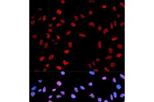 Immunofluorescence analysis of MCF-7 cells using Phospho-AKT(T450) Polyclonal Antibody (AKT1 抗体  (pThr450))