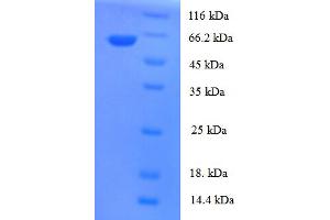 SDS-PAGE (SDS) image for Tubulin Folding Cofactor E-Like (TBCEL) (AA 1-424), (full length) protein (His-SUMO Tag) (ABIN4975775) (TBCEL Protein (AA 1-424, full length) (His-SUMO Tag))