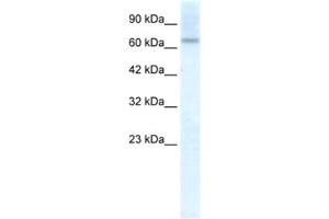 Western Blotting (WB) image for anti-Protein Inhibitor of Activated STAT, 2 (PIAS2) antibody (ABIN2461198) (PIAS2 抗体)