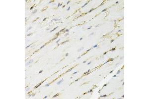 Immunohistochemistry of paraffin-embedded mouse heart using ANXA2 antibody. (Annexin A2 抗体)