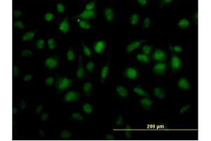 Immunofluorescence of monoclonal antibody to TOE1 on HeLa cell. (TOE1 抗体  (AA 1-510))