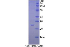 SDS-PAGE analysis of Human Aromatase Protein.
