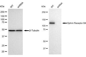 Western blotting analysis using Ephrin Receptor B4 antibody (ABIN7798459). (Recombinant Ephrin Receptor B4 抗体)