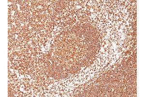 Immunohistochemistry (IHC) image for anti-Protein tyrosine Phosphatase, Receptor Type, C (PTPRC) antibody (ABIN6940460)