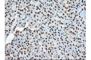 Immunohistochemical staining of paraffin-embedded Human colon tissue using anti-TACC3 mouse monoclonal antibody. (TACC3 抗体)