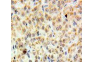 Used in DAB staining on fromalin fixed paraffin-embedded Ovary tissue (DDB2 抗体  (AA 166-383))