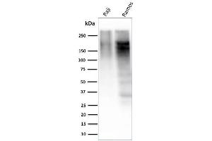 Western Blot Analysis of Raji and Ramos cell lysate using Ki67 Mouse Monoclonal Antibody (MKI67/2463). (Ki-67 抗体  (AA 2293-2478))