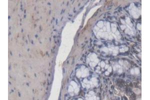 IHC-P analysis of Mouse Colon Tissue, with DAB staining. (Calcitonin Receptor 抗体  (AA 42-170))