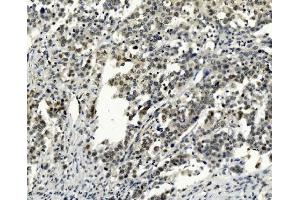 IHC analysis of SMAD2 using anti-SMAD2 antibody (ABIN7602542).