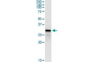 Western Blotting (WB) image for anti-Sulfotransferase Family 1B Member 1 (SULT1B1) (AA 1-296) antibody (ABIN949216)