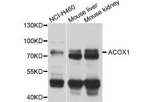 Western blot analysis of extract of various cells, using ACOX1 antibody. (ACOX1 抗体)