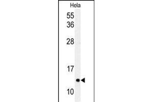 Western blot analysis of G8c (M1LC3C) Antibody (T48) 1804e in Hela cell line lysates (35 μg/lane). (MAP1LC3A 抗体  (AA 27-57))