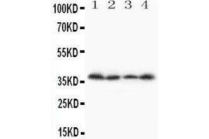 Anti-Stra8 antibody, Western blotting Lane 1: A231 Cell Lysate Lane 2: JURKAT Cell Lysate Lane 3:  Cell Lysate Lane 4: SCG Cell Lysate (STRA8 抗体  (C-Term))