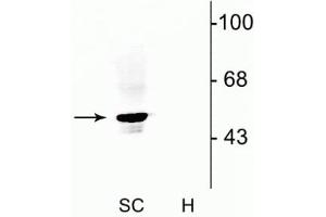 Western blot of rat spinal cord lysate (SC) showing specific immunolabeling of the ~48 kDa α1- and α2-subunits of the glycine receptor. (GLRA1 抗体  (N-Term))
