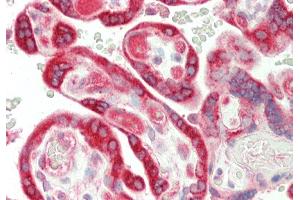 Rabbit Anti-TRIantibody  Formalin Fixed Paraffin Embedded Tissue: Human Placenta Primary antibody Concentration: 1:100 Secondary Antibody: Donkey anti-Rabbit-Cy3 Secondary Antibody Concentration: 1:200 Magnification: 20x Exposure Time: 0. (TRIP10 抗体  (N-Term))