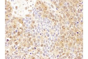 Immunohistochemistry (IHC) image for anti-Cyclin-Dependent Kinase 5, Regulatory Subunit 1 (p35) (CDK5R1) (AA 110-160) antibody (ABIN7453924)