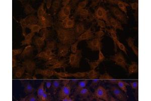 Immunofluorescence analysis of C6 cells using BID Polyclonal Antibody at dilution of 1:100. (BID 抗体)