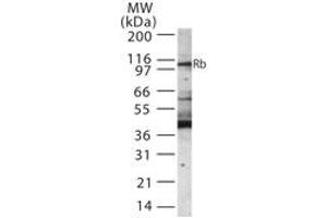 Western Blotting (WB) image for anti-Retinoblastoma Protein (Rb Protein) (AA 251-268) antibody (ABIN233206) (Retinoblastoma Protein (Rb) 抗体  (AA 251-268))
