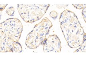 Detection of APOH in Human Placenta Tissue using Polyclonal Antibody to Apolipoprotein H (APOH) (APOH 抗体  (AA 22-345))