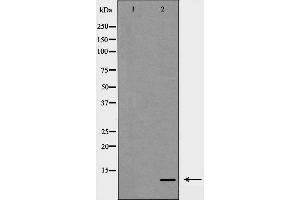 Western blot analysis of S100 A10 expression in COLO cells,The lane on the left is treated with the antigen-specific peptide. (S100A10 抗体  (Internal Region))