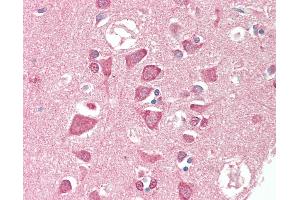 Anti-TSG / TWSG1 antibody IHC staining of human brain, cortex. (TWSG1 抗体  (AA 1-223))