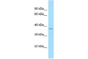 Western Blotting (WB) image for anti-Olfactory Receptor, Family 1, Subfamily A, Member 2 (OR1A2) (C-Term) antibody (ABIN2790831)