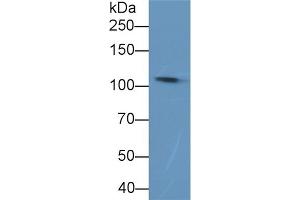 Detection of C5a in Rat Plasma using Polyclonal Antibody to Complement Component 5a (C5a) (C5A 抗体  (AA 679-755))