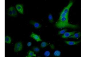 Immunofluorescence (IF) image for anti-S100 Calcium Binding Protein P (S100P) (AA 1-95) antibody (ABIN7434620)