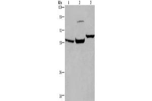 Western Blotting (WB) image for anti-Estrogen Receptor 1 (ESR1) antibody (ABIN2430022) (Estrogen Receptor alpha 抗体)