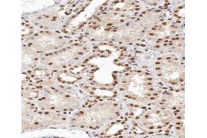 ABIN6267664 at 1/200 staining human kidney tissue sections by IHC-P. (MAPK14 抗体  (pTyr182))