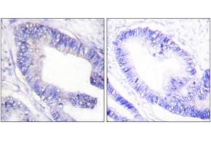 Immunohistochemistry (IHC) image for anti-Insulin Receptor Substrate 1 (IRS1) (AA 1067-1116), (pSer1101) antibody (ABIN1531290)