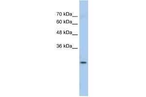 WB Suggested Anti-GSTM1 Antibody Titration:  0. (GSTM1 抗体  (N-Term))