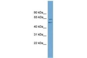 Image no. 1 for anti-NGFI-A Binding Protein 2 (EGR1 Binding Protein 2) (NAB2) (AA 351-400) antibody (ABIN6744542) (NAB2 抗体  (AA 351-400))