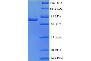 Tescalcin Protein (TESC) (AA 2-214) (His-SUMO Tag)
