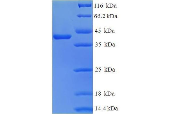 Tescalcin Protein (TESC) (AA 2-214) (His-SUMO Tag)
