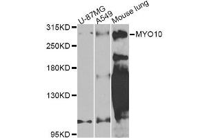 Western blot analysis of extracts of various cell lines, using MYO10 Antibody (ABIN5974593) at 1/1000 dilution. (Myosin X 抗体)