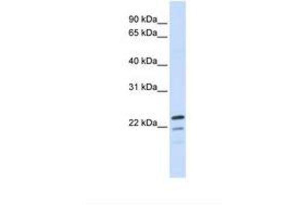 Receptor Accessory Protein 1 抗体  (AA 110-159)